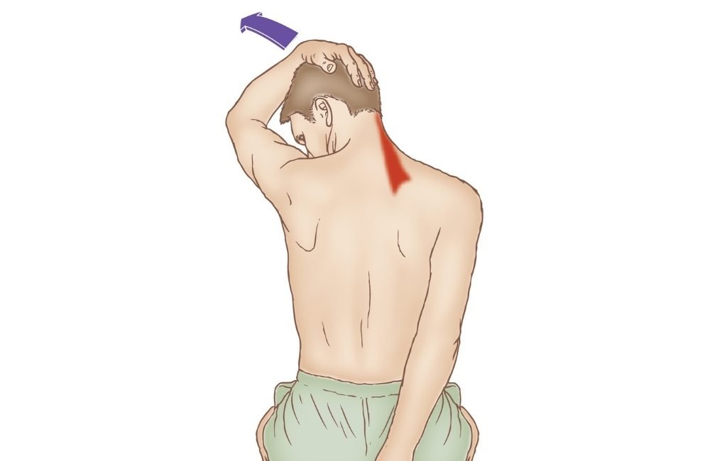 Levator Scapulae Release